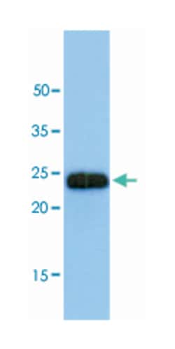 SAR1B, Mouse, Clone: AT1C7, Abnova 100 &mu;L | Buy Online | Abnova Corporation | Fisher Scientific