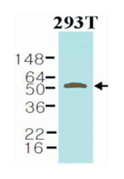 NAMPT, Mouse, Clone: 4D5, Abnova 100&mu;L; Unlabeled:Antibodies, Monoclonal