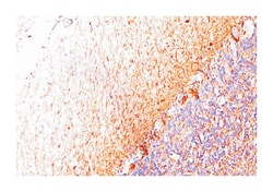 NEFH, Mouse, Clone: RT-97, Abnova 100&mu;g; Unlabeled:Antibodies, Monoclonal