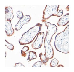 CGB, Mouse, Clone: HCGb/54, Abnova 100&mu;g; Unlabeled:Antibodies, Monoclonal