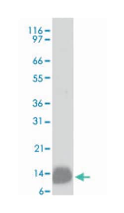 S100 Mouse anti-Bovine, Human, Mouse, Rat, Clone: 4C4.9, Abnova 100&mu;g;