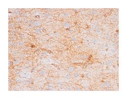 GFAP, Mouse, Clone: GA5, Abnova 100&mu;g; Unlabeled:Antibodies, Monoclonal