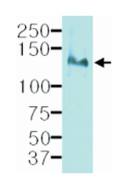 ITGB1, Mouse, Clone: k2D5, Abnova 100&mu;L; Unlabeled:Antibodies, Monoclonal