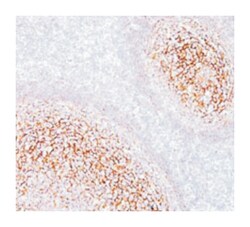 CD35 (CR1), Mouse, Clone: E11, Abnova 100 &mu;g | Buy Online | Abnova Corporation | Fisher Scientific