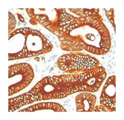 KRT18, Mouse, Clone: DA7, Abnova 100 &mu;g | Buy Online | Abnova Corporation | Fisher Scientific