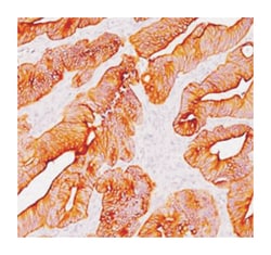 Pan Cytokeratin, Mouse, Clone: AE1 + AE3, Abnova 100&mu;g; Unlabeled:Antibodies,