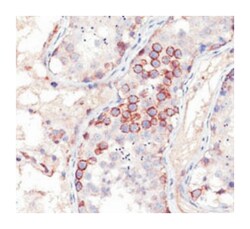 MAGE-1, Mouse, Clone: MA454, Abnova 100&mu;g; Unlabeled:Antikörper