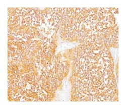 SILV, Mouse, Clone: HMB45, Abnova 500&mu;L; Unlabeled:Anticuerpos