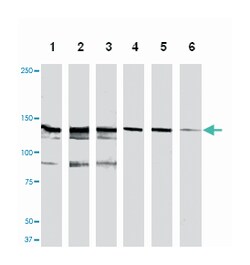 MET, Mouse, Clone: 4AT259, Abnova 400&mu;L; Unlabeled:Antibodies, Monoclonal