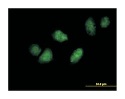 DEAD (Asp-Glu-Ala-Asp) box polypeptide 3, Y-linked, Mouse, Polyclonal Antibody, Abnova&trade;