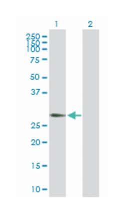 regulator of G-protein signaling 20, Rabbit, Purified MaxPab Polyclonal Antibody, Abnova 100 &mu;g | Buy Online | Abnova Corporation | Fisher Scientific