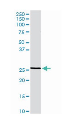regulator of G-protein signaling 20, Rabbit, Purified MaxPab Polyclonal Antibody, Abnova 100 &mu;g | Buy Online | Abnova Corporation | Fisher Scientific