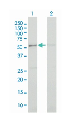 cell division cycle 2-like 5 (cholinesterase-related cell division controller), Mouse, Clone: 3G1, Abnova 100 &mu;g | Buy Online | Abnova Corporation | Fisher Scientific