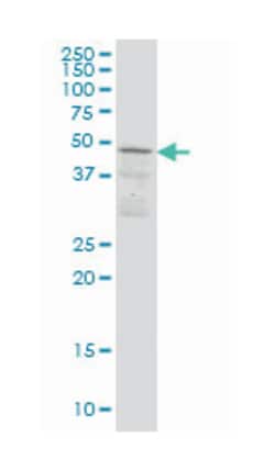 src kinase associated phosphoprotein 1, Mouse, Clone: 1C11, Abnova 100&mu;g;