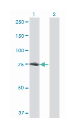 DEAD (Asp-Glu-Ala-Asp) box polypeptide 3, Y-linked, Mouse, Polyclonal Antibody, Abnova&trade;