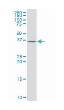 eukaryotic translation initiation factor 3, subunit H, Mouse, Clone: 3B12,