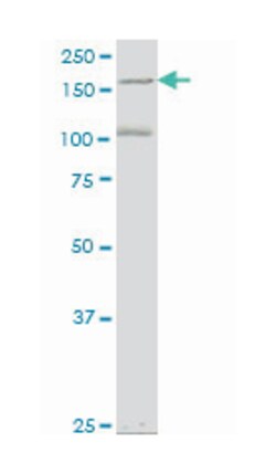 eukaryotic translation initiation factor 4 gamma, 3, Mouse, Clone: 1H5, Abnova&trade;