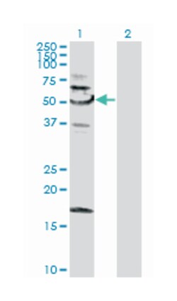 sorting nexin 4, Mouse, Purified MaxPab Polyclonal Antibody, Abnova 50&mu;g;