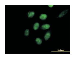 embryonic ectoderm development, Mouse, Purified MaxPab Polyclonal Antibody, Abnova 50 &mu;g | Buy Online | Abnova Corporation | Fisher Scientific
