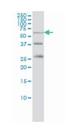 RIOK3, Mouse, Clone: 3G11, Abnova 200&mu;L; Unlabeled:Antibodies, Monoclonal