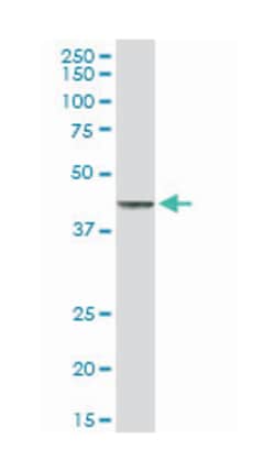tumor necrosis factor receptor superfamily, member 10b, Rabbit, Purified