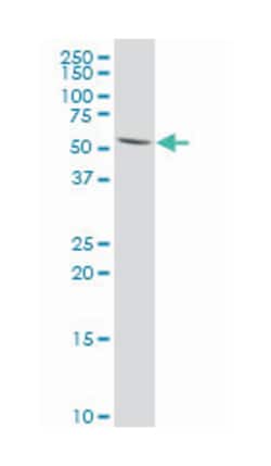tumor necrosis factor receptor superfamily, member 10a, Mouse, Polyclonal Antibody, Abnova™