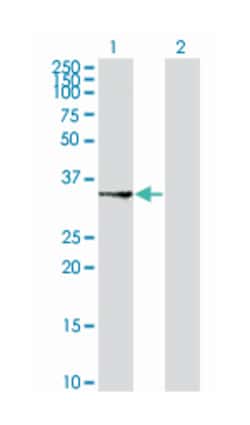 SUCLG1, Mouse, Polyclonal Antibody, Abnova 50&mu;L; Unlabeled:Antibodies,