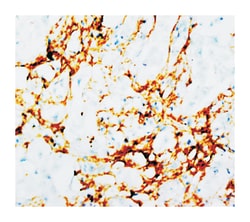 TNN, Mouse, Clone: T20, Abnova 100&mu;g; Unlabeled:Antibodies, Monoclonal