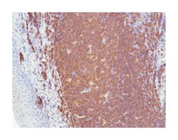 MS4A1, Rabbit, Clone: SP32, Abnova 100 &mu;L | Buy Online | Abnova Corporation | Fisher Scientific