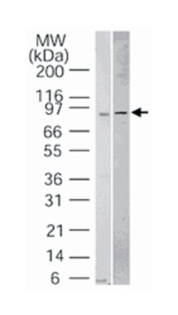 IRAK1 Rabbit anti-Human, Mouse, Polyclonal Antibody, Abnova 100 &mu;g | Buy Online | Abnova | Fisher Scientific