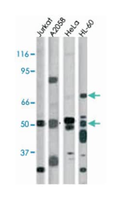 CHEK1 (phospho S317), Rabbit anti-Human, Polyclonal Antibody, Abnova 400&mu;L;