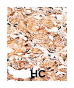 RAD9A (phospho S277), Rabbit anti-Human, Polyclonal Antibody, Abnova 400&mu;L;