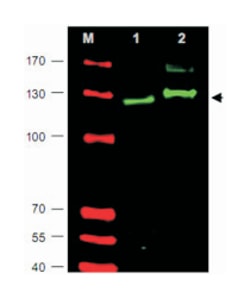 GLI2, Rabbit, Polyclonal Antibody, Abnova 100&mu;g; Unlabeled:Antibodies,