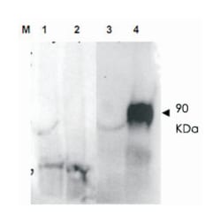 Fap, Rabbit, Polyclonal Antibody, Abnova 100&mu;g; Unlabeled:Antibodies,