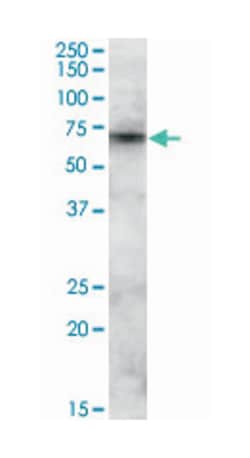 ABCD3, Goat, Polyclonal Antibody, Abnova 100&mu;g; Unlabeled:Antibodies,