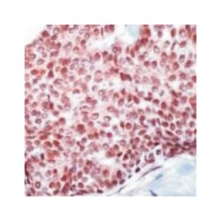 Usf2, Rabbit, Polyclonal Antibody, Abnova 100&mu;L; Unlabeled:Antibodies,