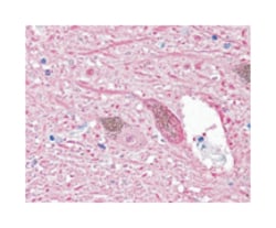 UCHL1 Rabbit anti-Horse, Human, Mouse, Pig, Primates, Rat, Polyclonal Antibody,