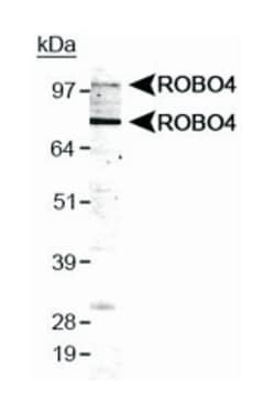 ROBO4 Rabbit anti-Human, Polyclonal Antibody, Abnova 100&mu;L; Unlabeled:Anticuerpos