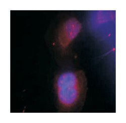 BRCA1 (phospho S988), Rabbit anti-Human, Polyclonal Antibody, Abnova 100&mu;g;