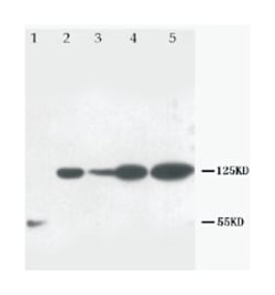 NOTCH1 Rabbit anti-Human, Polyclonal Antibody, Abnova 100&mu;g; Unlabeled:Antibodies,