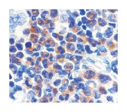 DAPK2 Rabbit anti-Human, Mouse, Rat, Polyclonal Antibody, Abnova 100&mu;g;