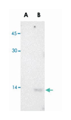West Nile Virus Core Rabbit anti-Viruses, Polyclonal Antibody, Abnova 100&mu;g;