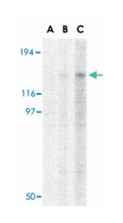 TBC1D1, Rabbit, Polyclonal Antibody, Abnova 100&mu;g; Unlabeled:Antibodies,