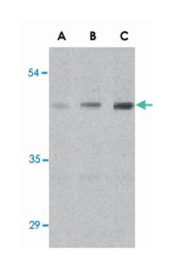 ANTXR1 Rabbit anti-Human, Mouse, Rat, Polyclonal Antibody, Abnova 100&mu;g;