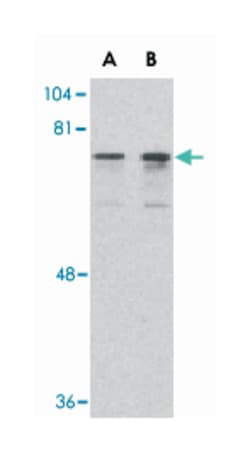 DDX3X Rabbit anti-Human, Mouse, Polyclonal Antibody, Abnova 100&mu;g; Unlabeled:Antibodies,