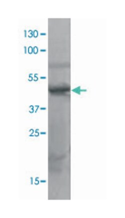 SOX3, Rabbit, Polyclonal Antibody, Abnova 100&mu;g; Unlabeled:Antibodies,