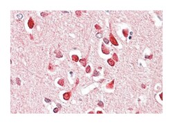 UNC5C, Goat, Polyclonal Antibody, Abnova 100 &mu;g | Buy Online | Abnova Corporation | Fisher Scientific