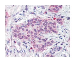 MMP13 Rabbit anti-Human, Polyclonal Antibody, Abnova 50&mu;g; Unlabeled:Antibodies,