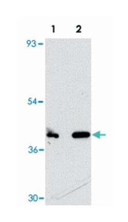 CUEDC1, Rabbit, Polyclonal Antibody, Abnova 100 &mu;g | Buy Online | Abnova | Fisher Scientific