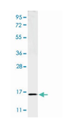 TNF Rabbit anti-Pig, Polyclonal Antibody, Abnova 100&mu;g; Unlabeled:Antibodies,